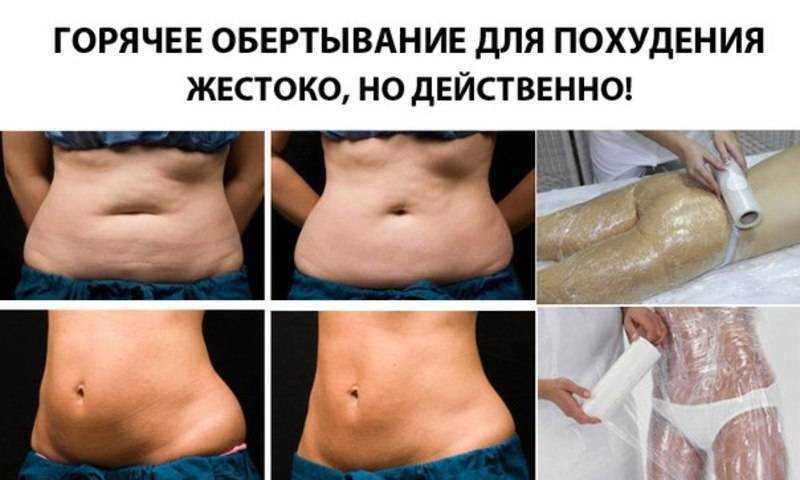 Редька для похудения: выбор, правила использования, рецепты